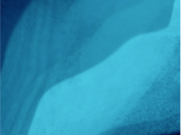 blue background