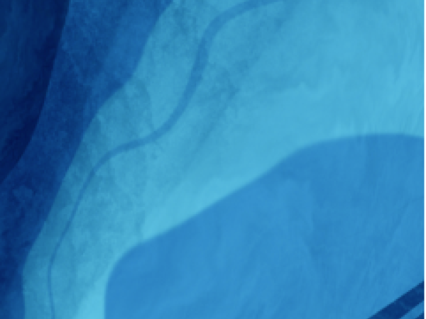 blue card background